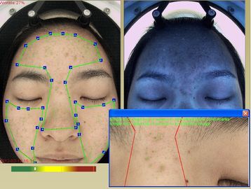 مستحضرات التجميل باستخدام آلة تحليل التجاعيد ثلاثية الأبعاد RGB + UV + PL 3 الأطياف
