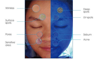 RGB PL UV Light Skin Hydration Analyder لاكتشاف مشكلة الجلد
