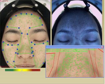 آلة محلل ترطيب بشرة الوجه 3D المهنية مع شاشة تعمل باللمس