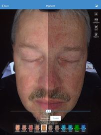 الوجه محلل الجلد 3D الماسح الضوئي Visia 32GB تخزين لعيادة طبيب الجلد