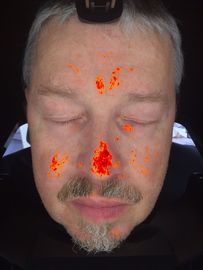 3D الرقمية محلل الجلد ماجيك تستر مرآة لعيادة معالج التجميل