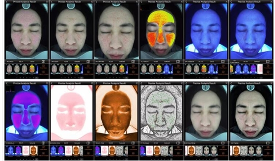 محلل الجلد الذكي RGB UV PL