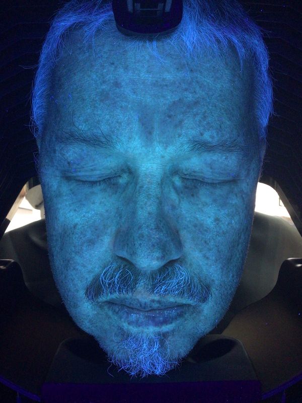VISIA Face Scanner Analysis Magic Mirror Skin Analyser فاحص الجلد المهني لعيادة الطبيب Usd 3D Function CE FCC