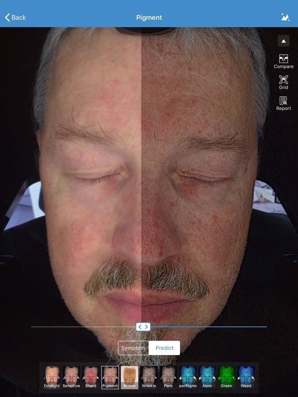 الوجه محلل الجلد 3D الماسح الضوئي Visia 32GB تخزين لعيادة طبيب الجلد